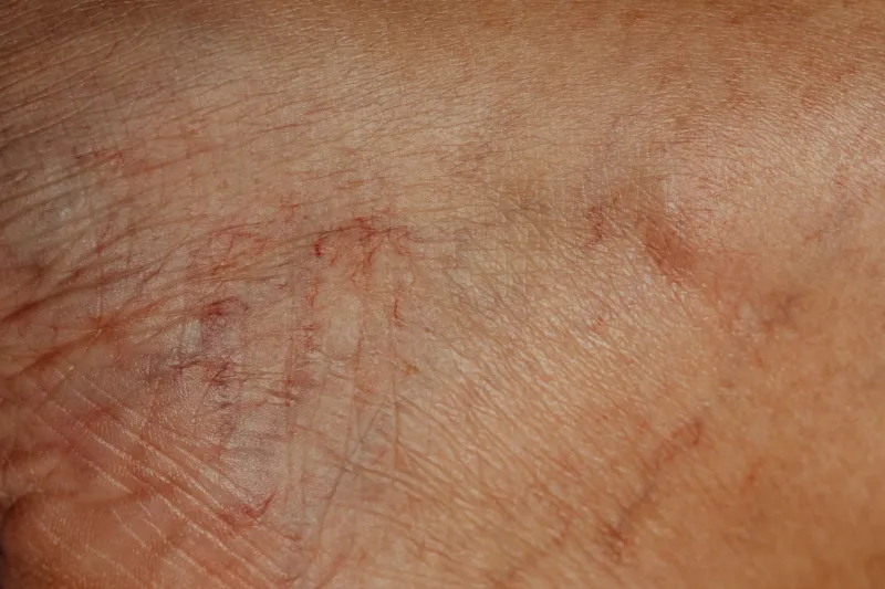 Your Blood Has Never Been Blue — Even When It's Running Through Your Veins Right Now